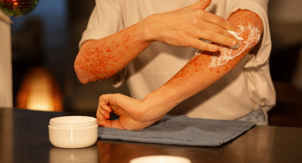 fungal infections treatment Pune
