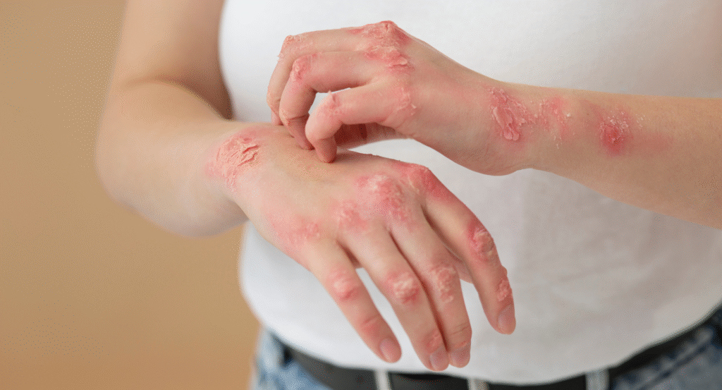 Skin Specialist in Pune for Rashes